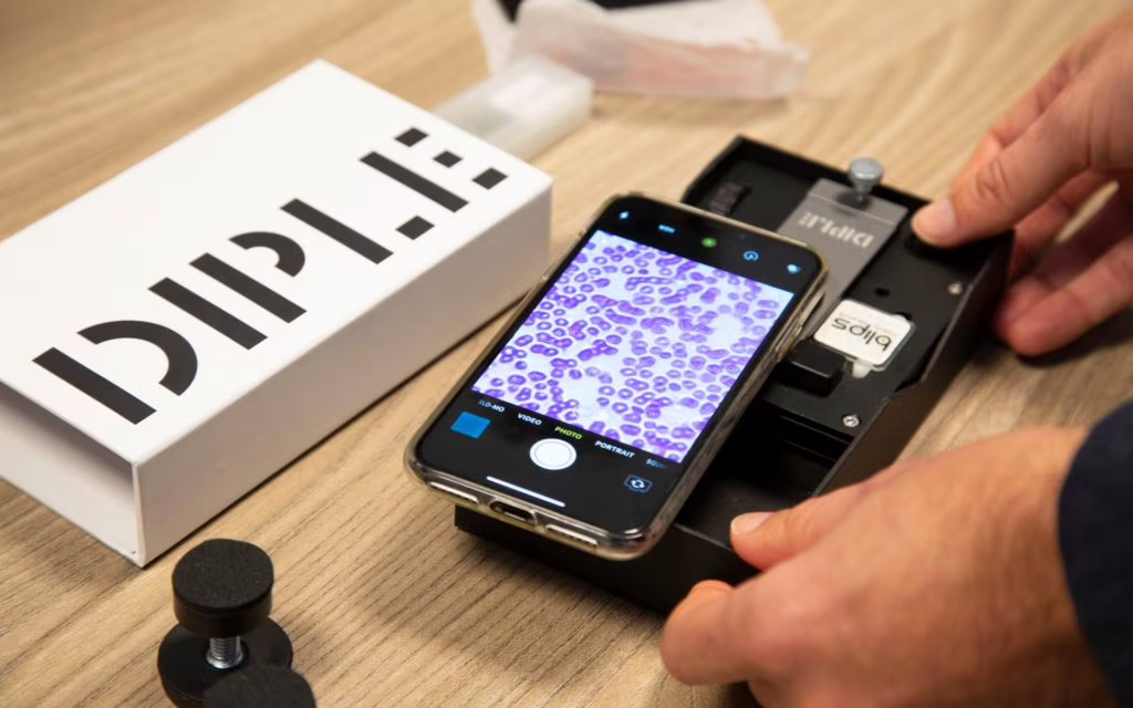 DIPLE: come trasformare uno smartphone in un microscopio portatile