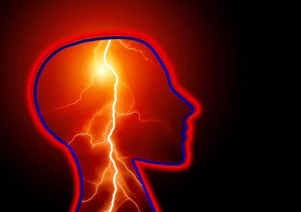 Epilessia