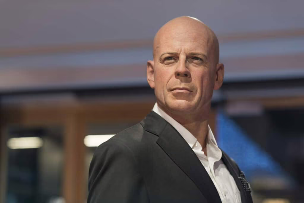 Afasia: cos’è, diagnosi e trattamento della malattia di Bruce Willis