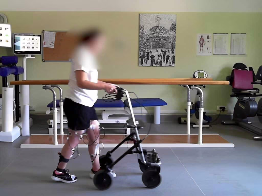 Paralizzata da 5 anni ritorna a camminare con neurostimolatore