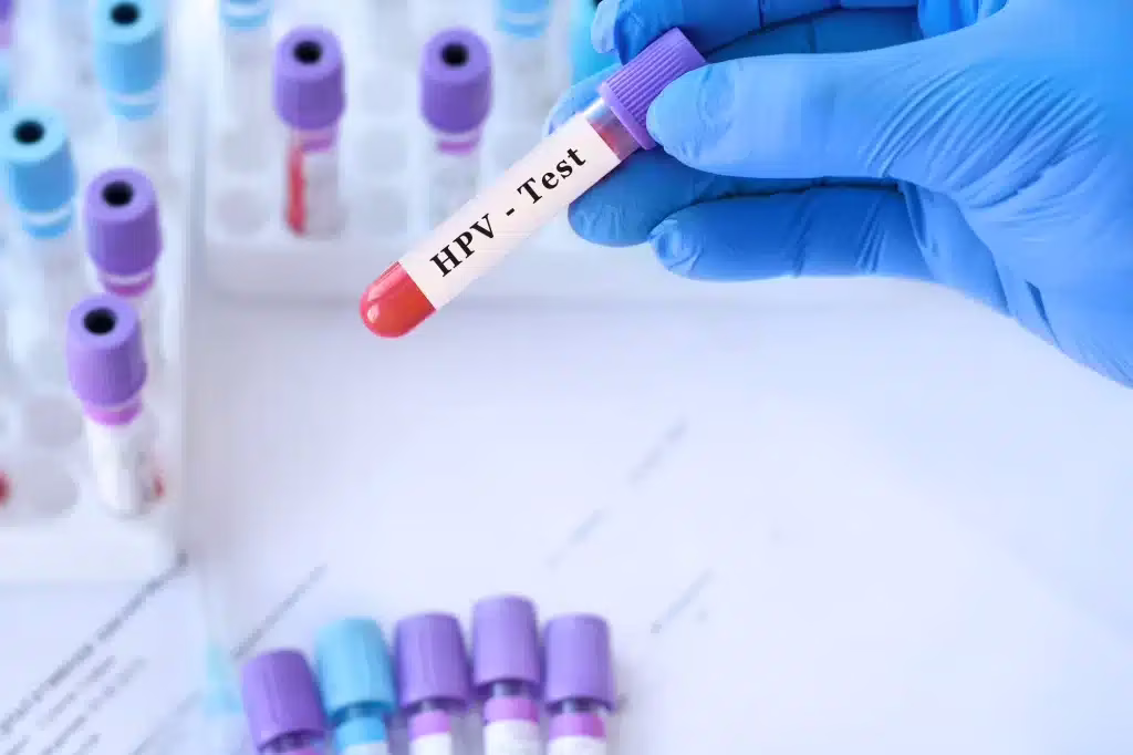 Un test innovativo rileva il DNA dell’HPV direttamente da un campione auto-prelevato