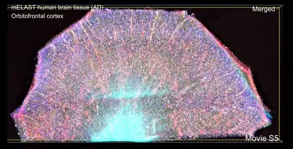 Dal MIT una rivoluzionaria piattaforma per vedere il cervello con una risoluzione senza precedenti