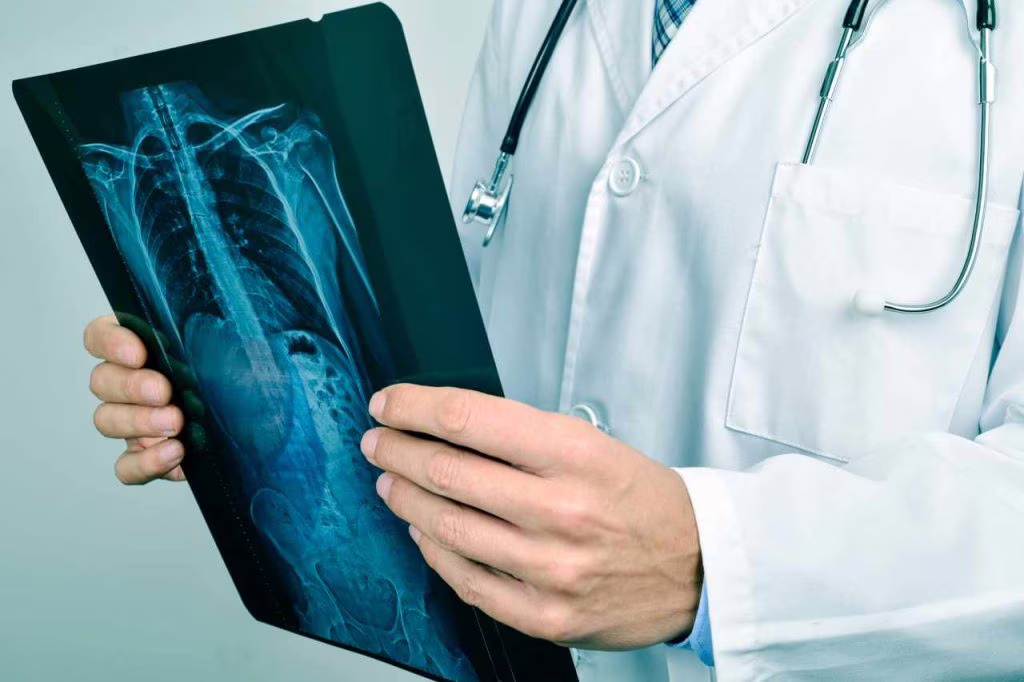 Radiografia alla colonna dorsale: in cosa consiste e quando è consigliata?