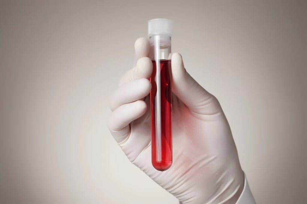 Profilo lipidico: un test importante per la propria salute cardiovascolare