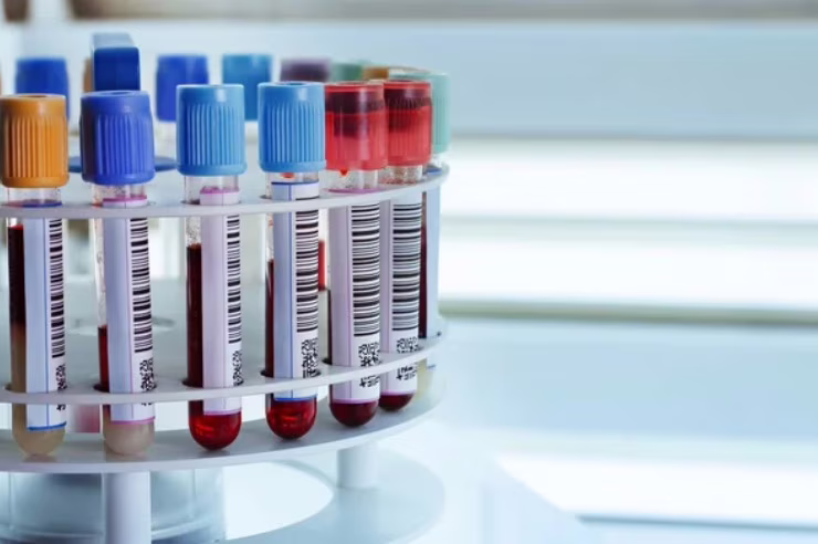 Provette di sangue