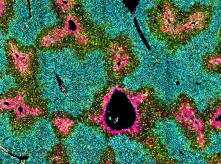 Cellule stellate epatiche (dkfz foto)