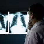 Valutazione cancro polmonare