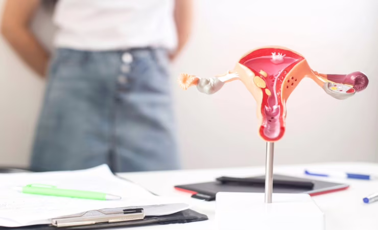 PCOS 