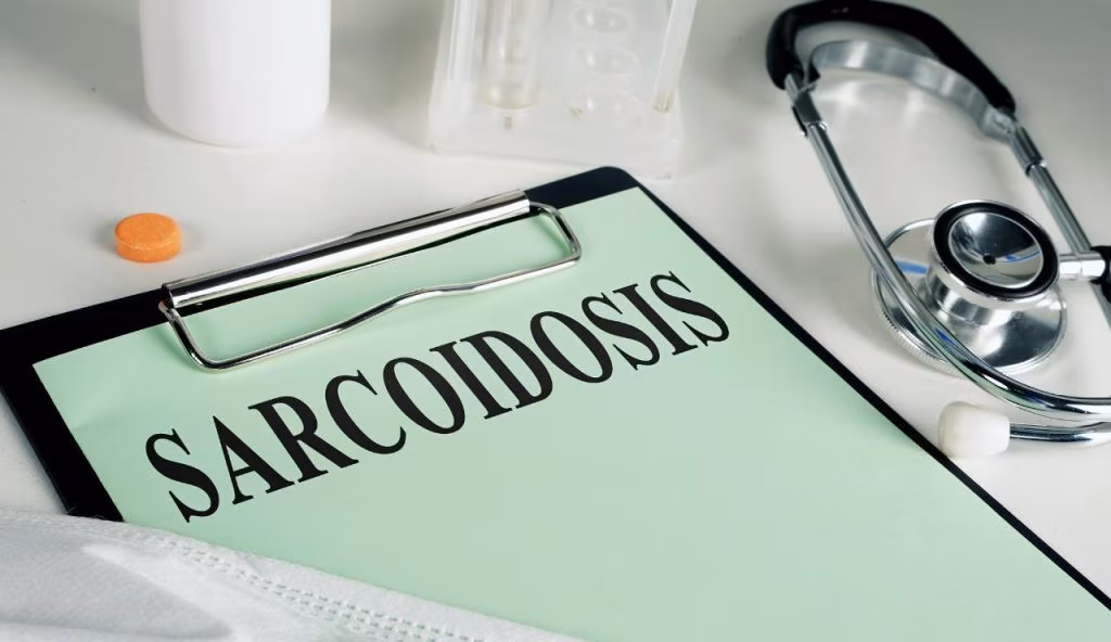 4 metodi innovativi per il trattamento della sarcoidosi