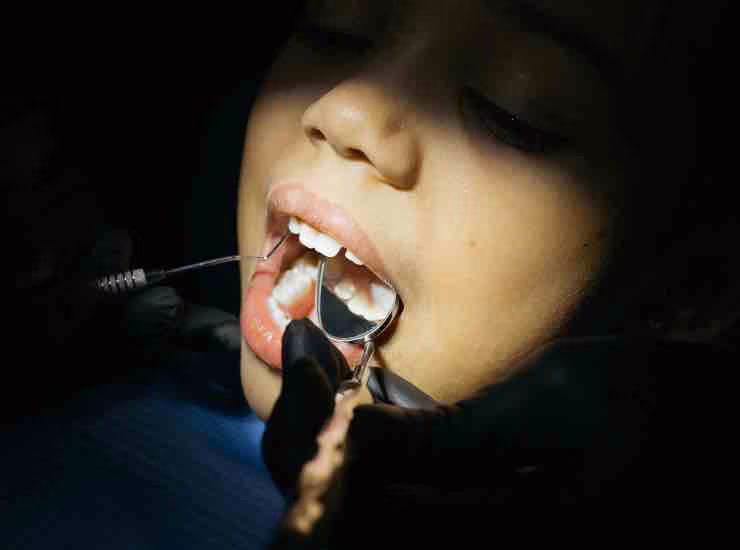 dentista (pexels) - cataniaoggi