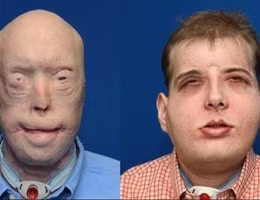 20151117_video_10374896_large