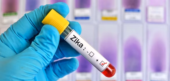 Zika-Virus