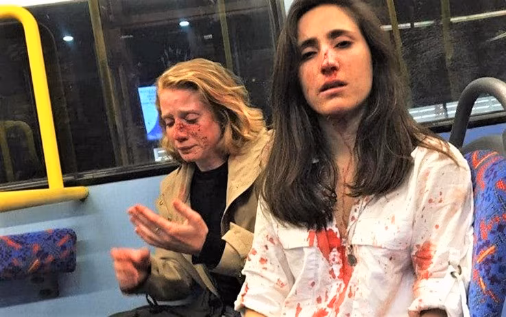 Gb: lesbiche rifiutano baciarsi su bus, picchiate da omofobi