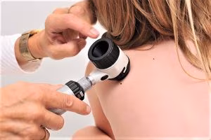 medicocontrollo-nevi