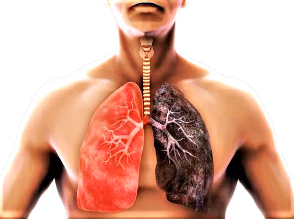 polmoni-removebg-preview