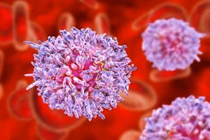 Tumore-Linfocita-B-leggera