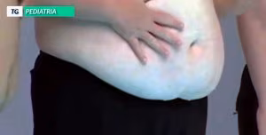 tgpediatria