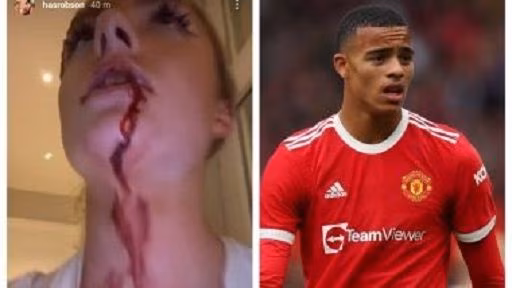 Calcio/ La fidanzata accusa Greenwood: "Mi picchiava a sangue"
