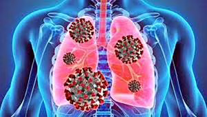 fibrosi polmonari (1)