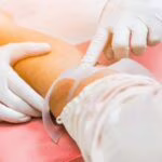 Focolaio di tubercolosi ad Alcamo, la nota dell’Asp: “Situazione sotto controllo”