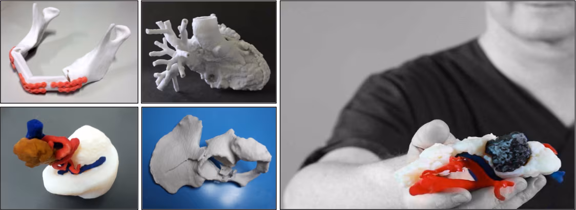 3D4Med