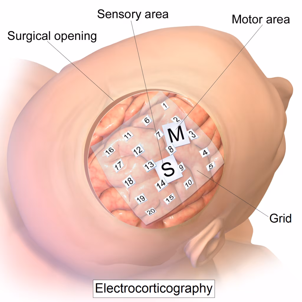 Interfacce neurali: sviluppata la prima protesi cerebrale “Plug-and-play”. Credits: Blausen.com staff (2014)