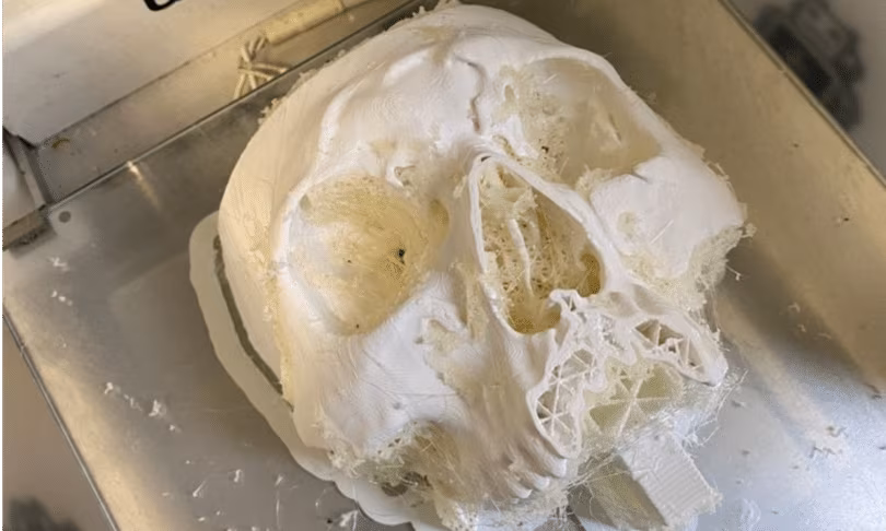 Torino: ricostruzione volto 3D con pianificazione chirurgica virtuale