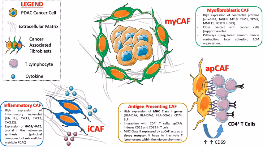 CANCRO AL PANCREAS: UN NUOVA SCOPERTA PROMETTENTE