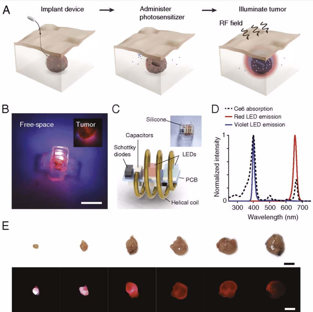 Fotodinamica dispositivo impiantabile