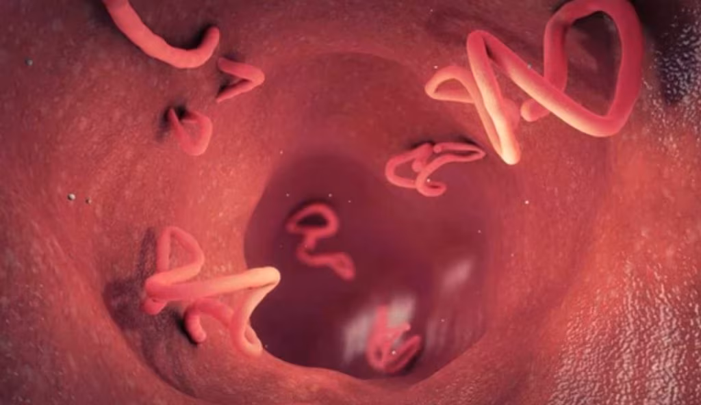 Parassiti intestinali: basta questa spezia ogni giorno che ti aiuta ad eliminarli per sempre
