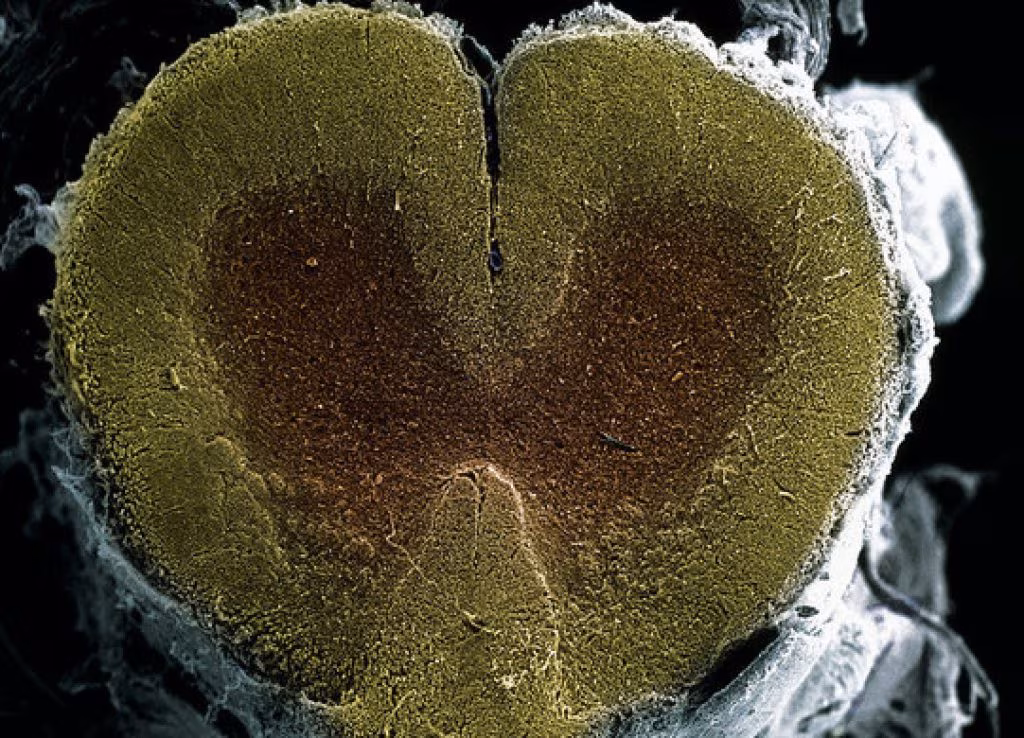 Arriva il primo midollo spinale stampato 3D