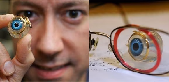 Occhio bionico consente recupero parziale della vista a 5 non vedenti
