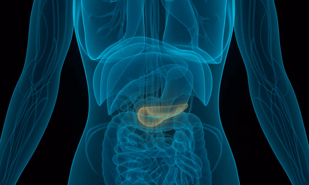 Cancro al pancreas: nuova terapia con impianto radioattivo