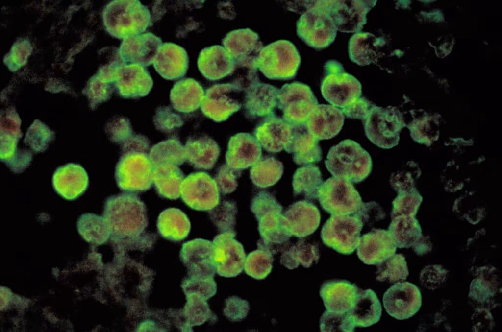 Ameba mangia-cervello o Naegleria fowleri: cos’è, sintomi dell’infezione e prevenzione