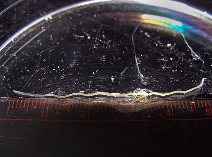 verme loa loa nella congiuntiva