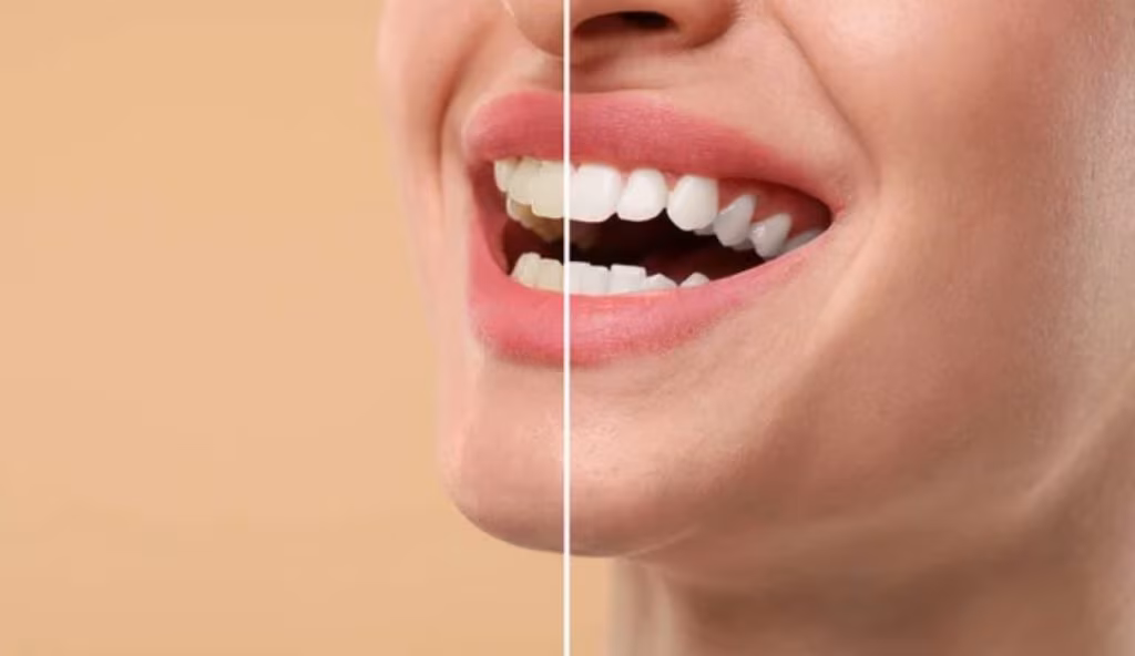 Avere denti bianchi
