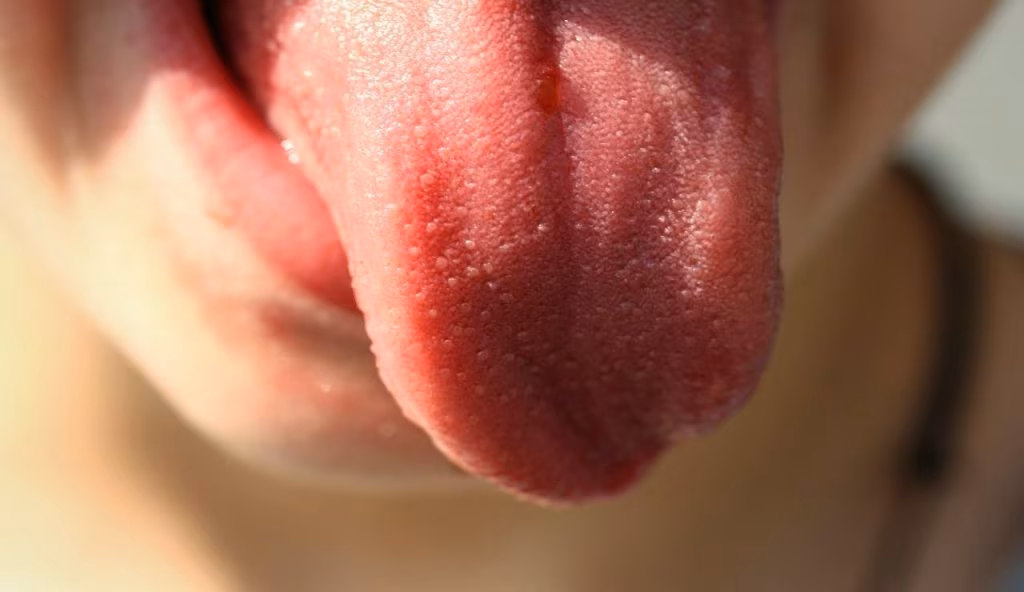 lingua rosa