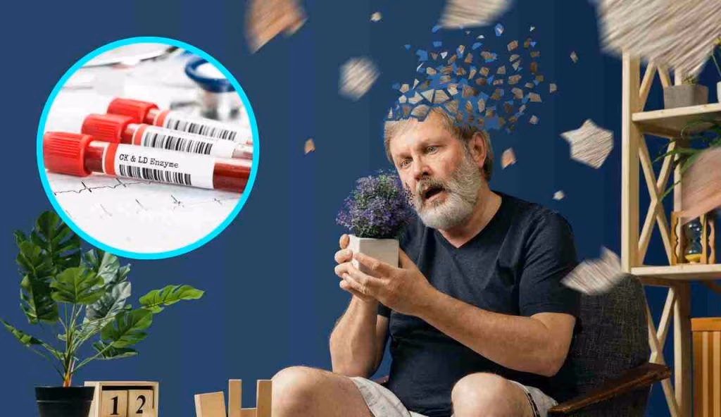 Alzheimer