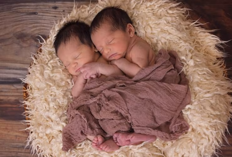 Illustrazione di gemelli siamesi (Canva FOTO) - biomedicalcue.it