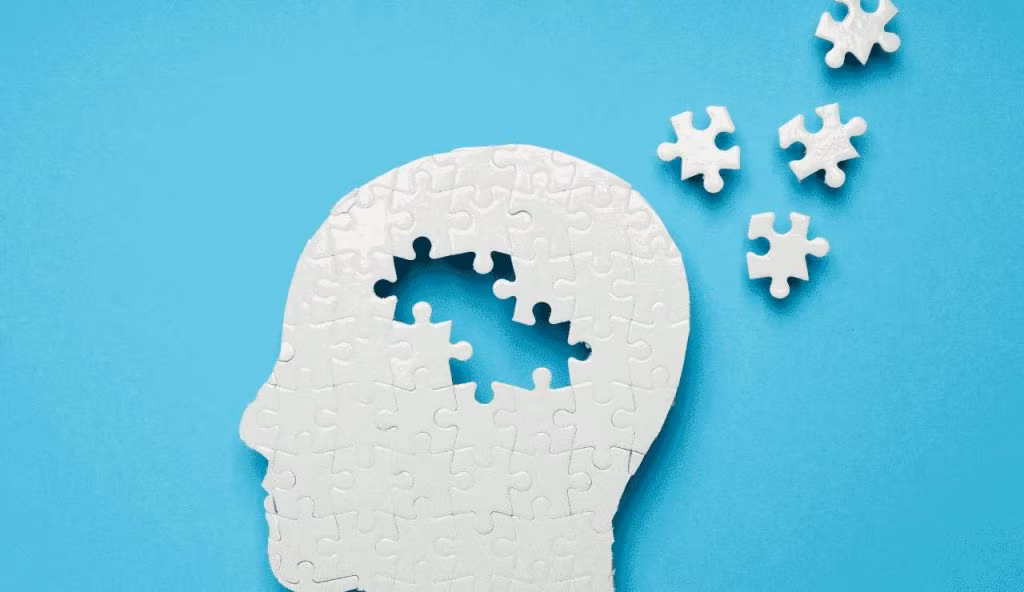 Alzheimer rappresentazione