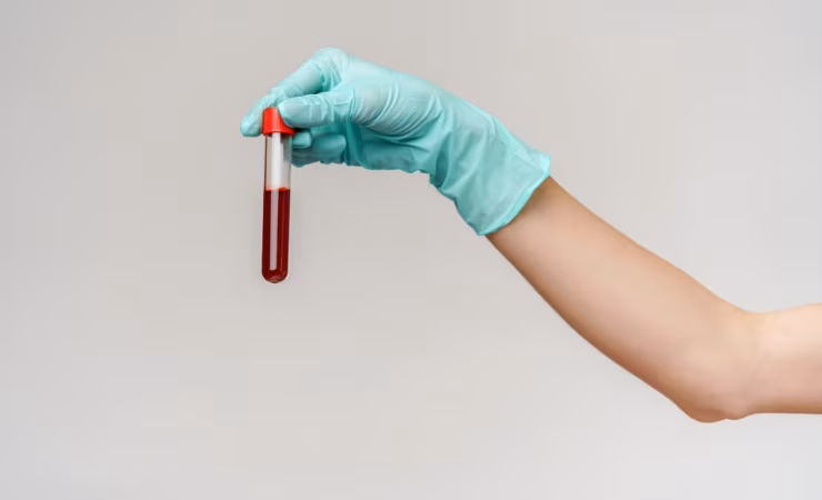Ampolla di sangue
