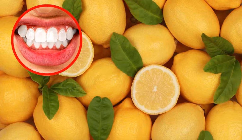 Denti e limone