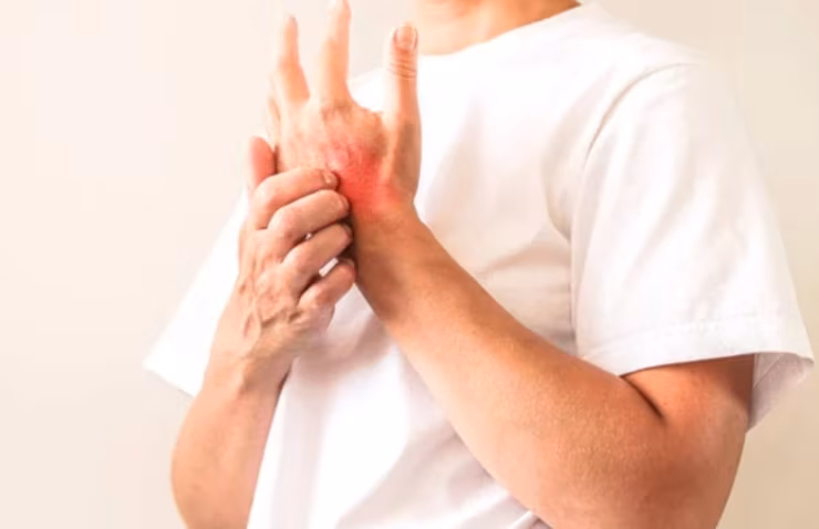 Scabbia (Depositphotos foto) - www.biomedicalcue.it