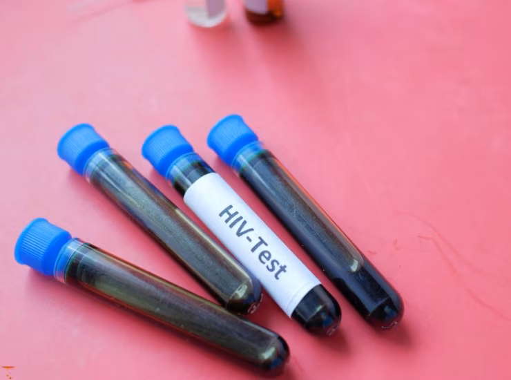 Illustrazione di un test dell'HIV e dell'epatite (Canva FOTO) - biomedicalcue.it