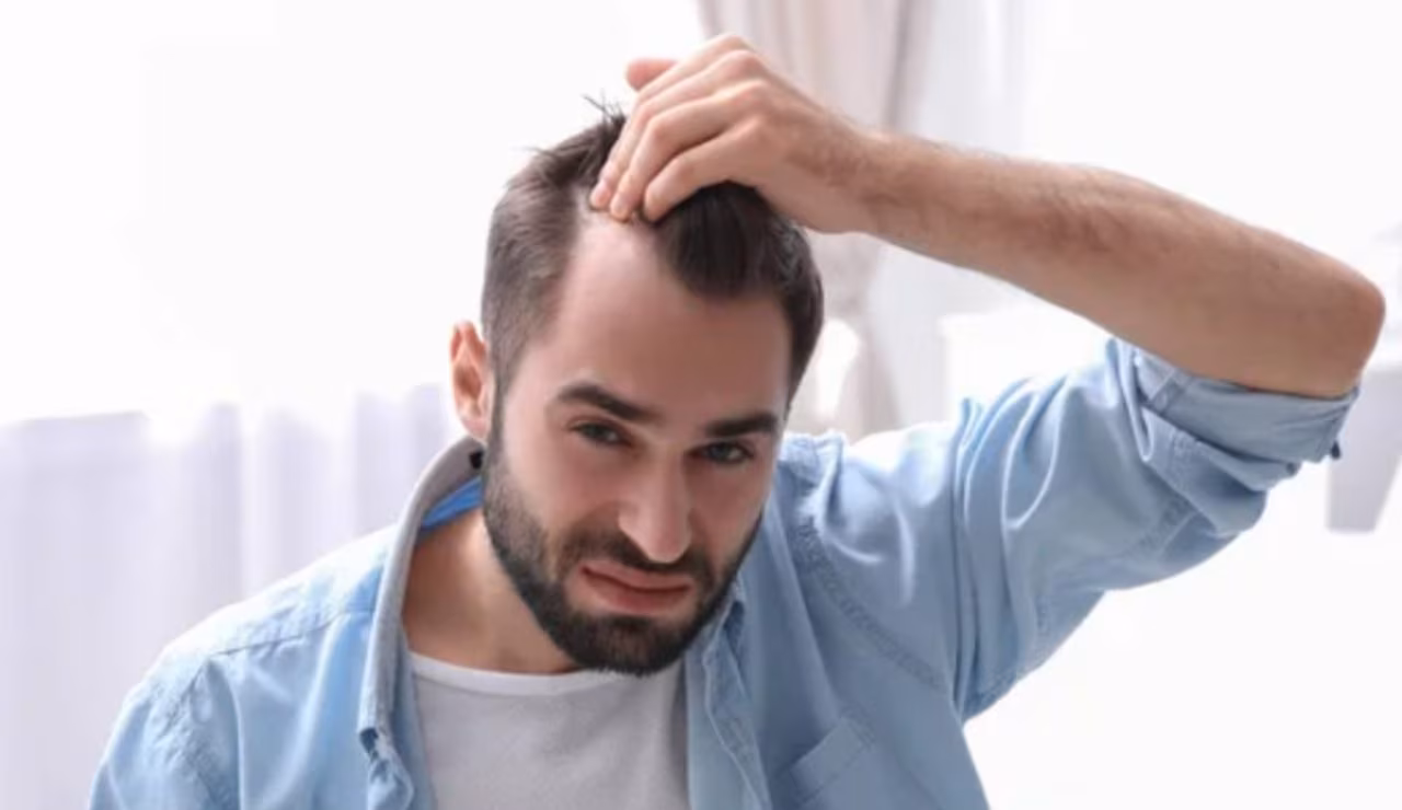 Calvizie (Depositphotos foto) - www.biomedicalcue.it