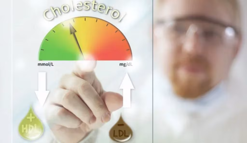 Colesterolo