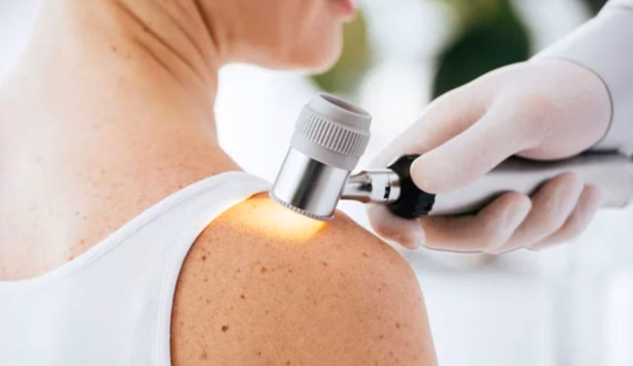 Controllo dei nei (Depositphotos foto) - www.biomedicalcue.it