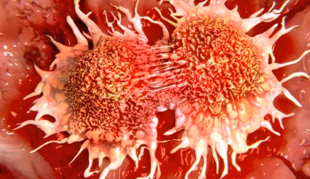 Illustrazione di una cellula tumorale (Canva FOTO) - biomedicalcue.it