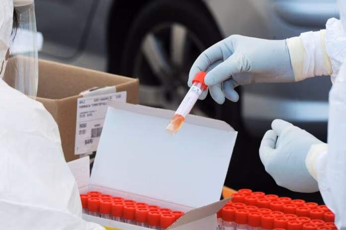 Covid, primo caso di variante Omicron in Veneto