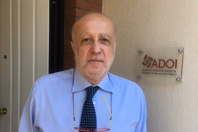 Sos psoriasi, dermatologi ADOI istituiscono numero verde per i pazienti